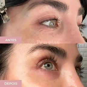 Creme Antirrugas Instantâneo - (8 Horas de Duração) ®