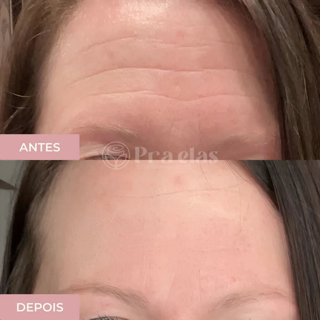 Creme Antirrugas Instantâneo - (8 Horas de Duração) ®